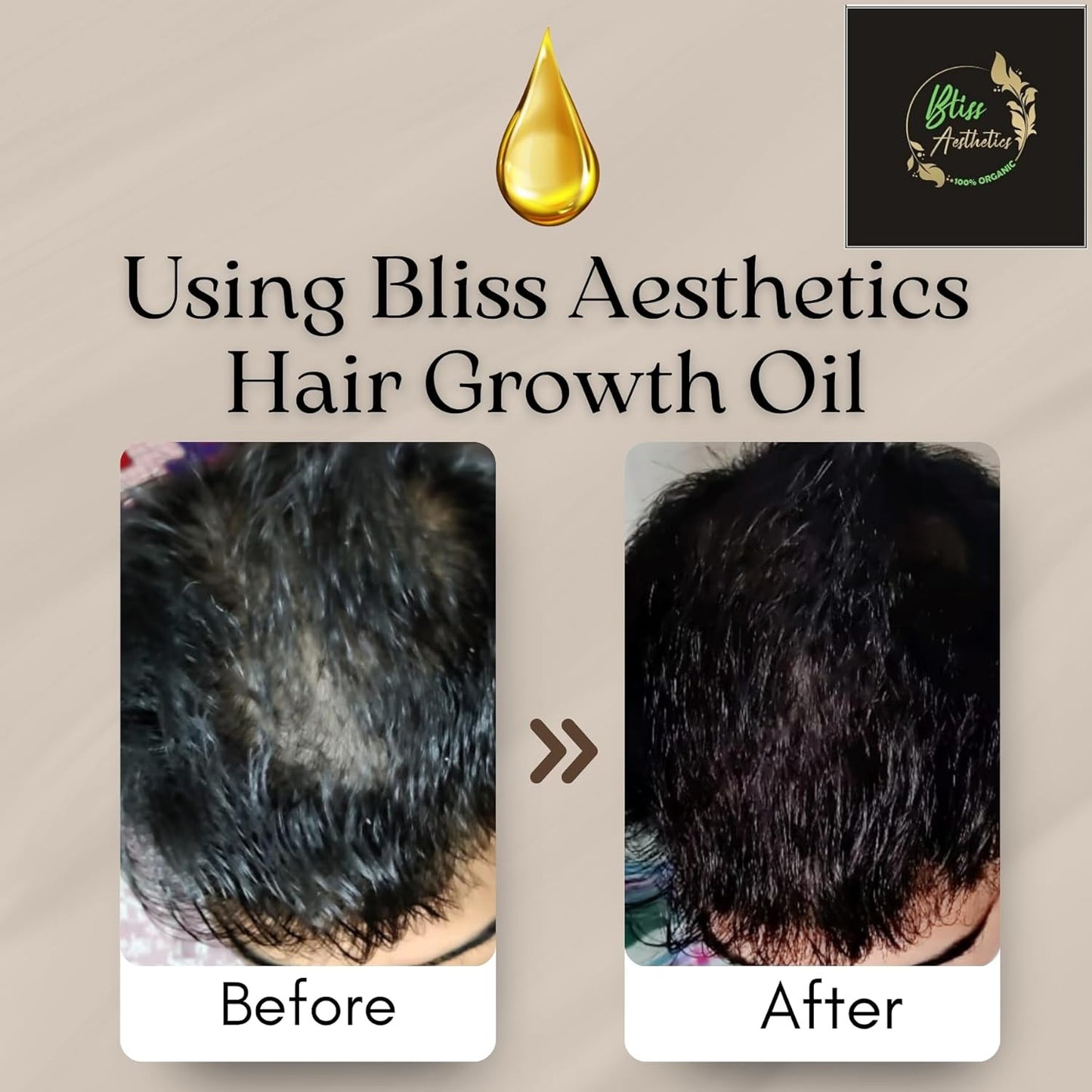 Bliss Aesthetics Hair Fall Control Oil | Ayurvedic Formula with Amla & Methi | Non-Sticky & Lightweight | Reduces Hair Fall & Strengthens Roots (110ml)