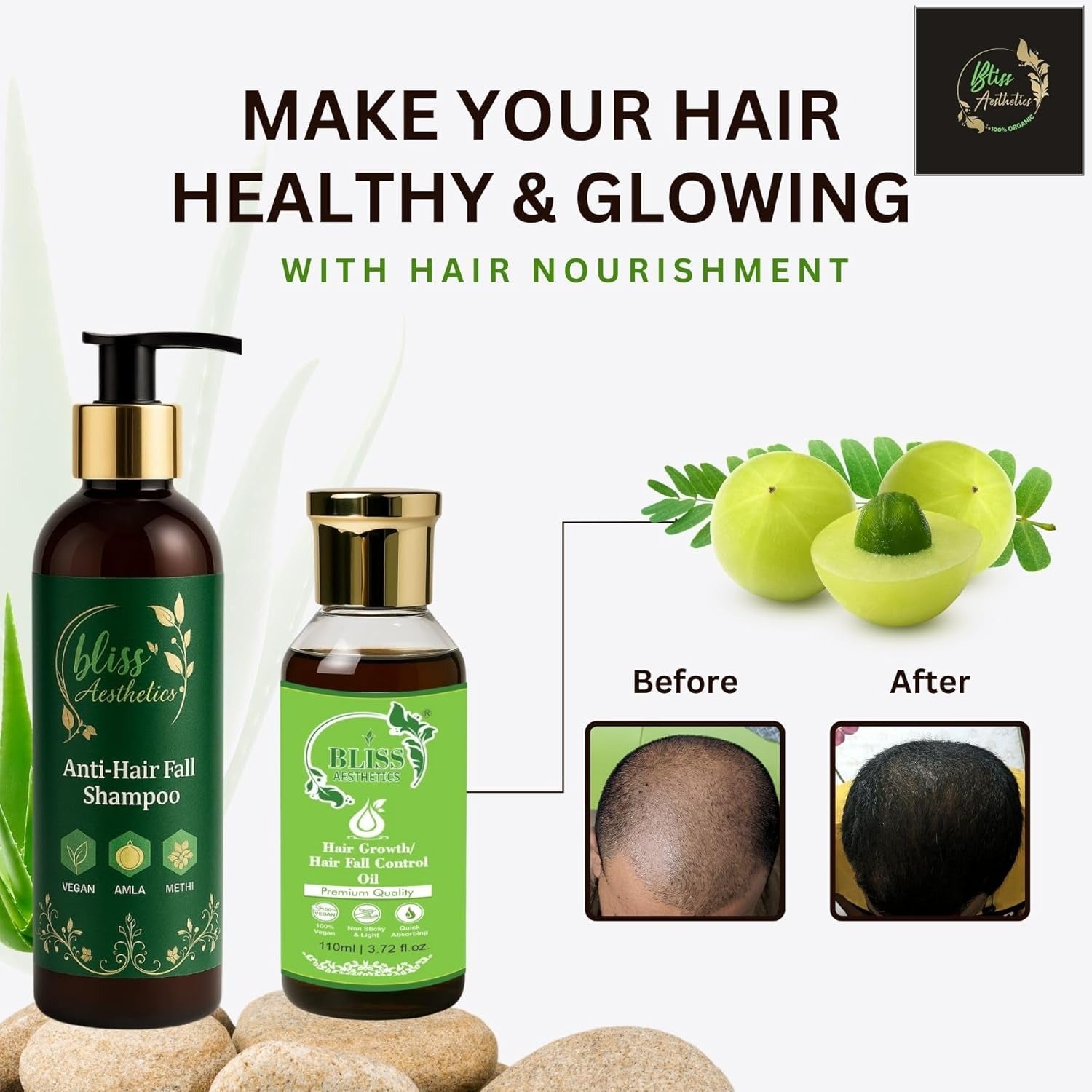 Bliss Aesthetics Anti-Hair Fall Shampoo 200ml | Controls Hair Fall | Promotes Hair Growth | Sulfate-Free